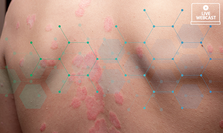 Derma Unplugged 2.0: The Connection Between HS and Psoriasis - News Directory 3